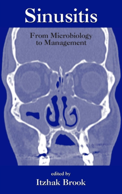 Book cover of: Sinusitis. By: Itzhak Brook