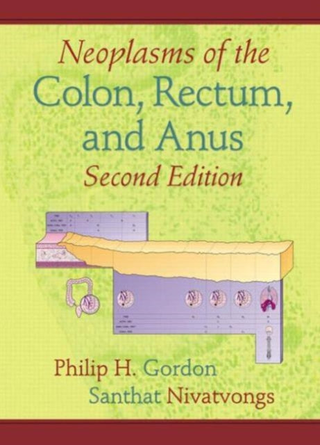 Book cover of: Neoplasms of the Colon, Rectum, and Anus. By: Gordon, Philip H., Philip H. Gordon