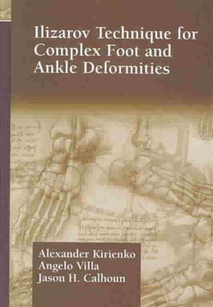 Ilizarov Technique for Complex Foot and Ankle Deformities