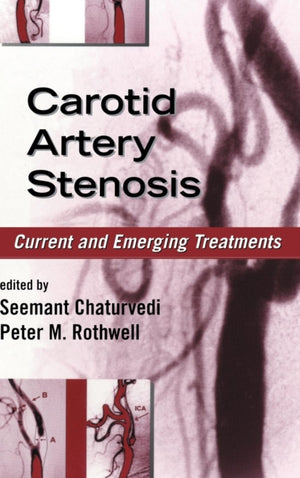 Carotid Artery Stenosis