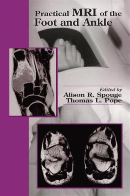 Book cover of: Practical MRI of the Foot and Ankle