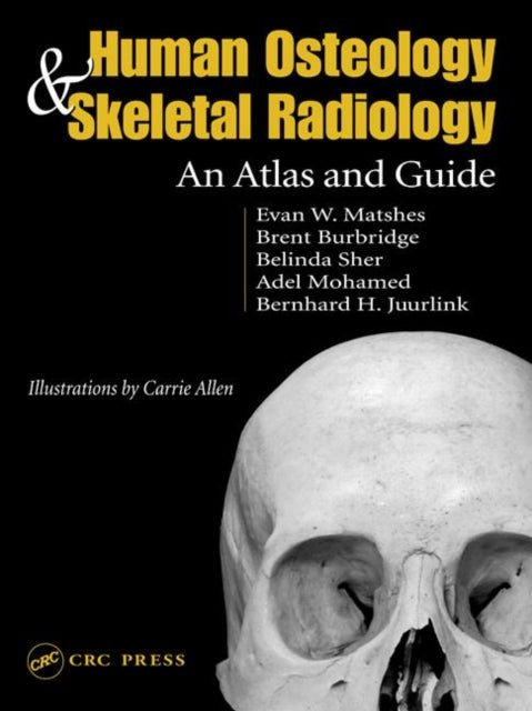 Book cover of: Human Osteology and Skeletal Radiology. By: Evan W. Matshes