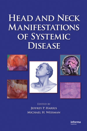 Head and Neck Manifestations of Systemic Disease