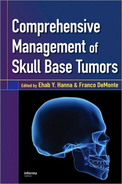 Book cover of: Comprehensive Management of Skull Base Tumors