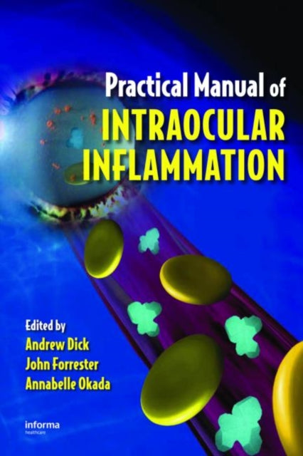 Book cover of: Practical Manual of Intraocular Inflammation. By: Andrew D. Dick, Andrew Dick