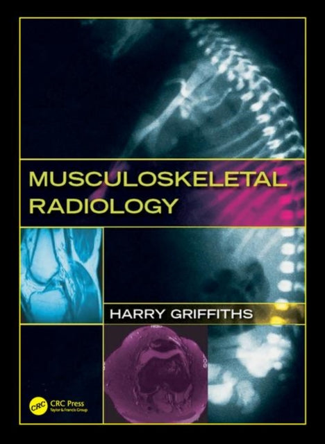 Book cover of: Musculoskeletal Radiology. By: Harry Griffiths
