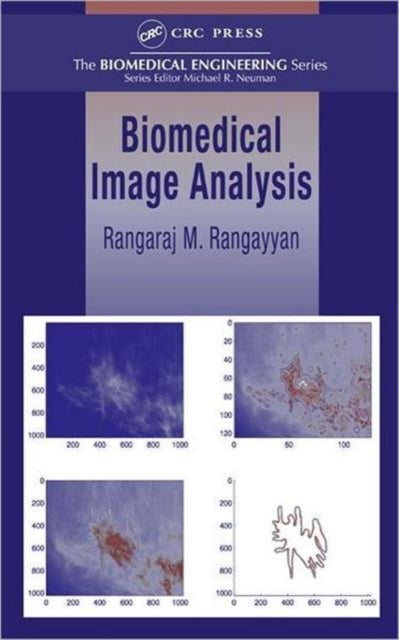 Book cover of: Biomedical Image Analysis. By: Rangaraj M. Rangayyan