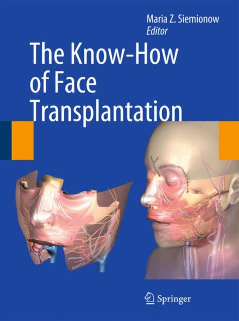 Book cover of: Know-How of Face Transplantation. By: Maria Z. Siemionow