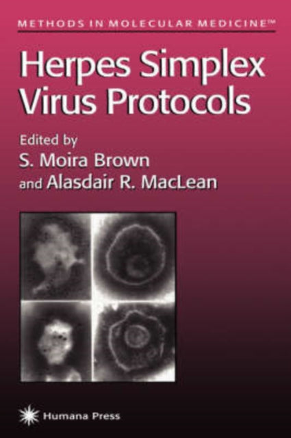 Book cover of: Herpes Simplex Virus Protocols