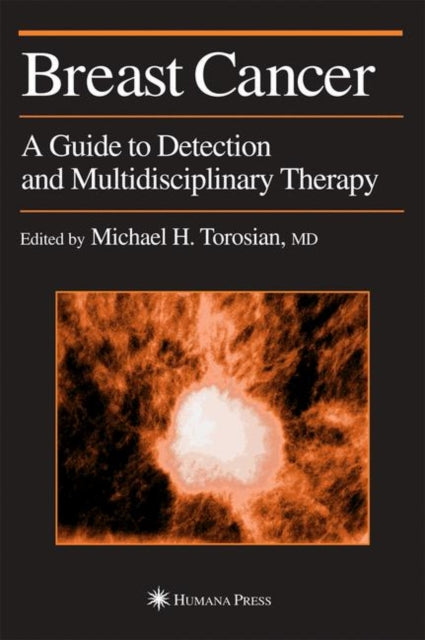 Book cover of: Breast Cancer. By: Michael H. Torosian
