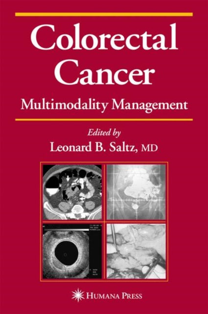 Book cover of: Colorectal Cancer. By: Leonard B. Saltz