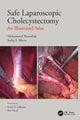 Book cover of: Safe Laparoscopic Cholecystectomy. By: Mohammad Ibrarullah