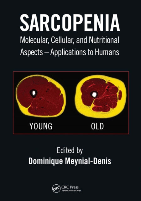 Book cover of: Sarcopenia. By: Dominique Meynial-Denis