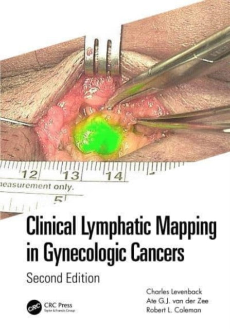 Book cover of: Clinical Lymphatic Mapping in Gynecologic Cancers. By: Charles Levenback