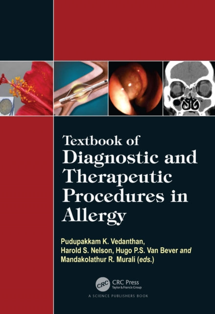 Book cover of: Textbook of Diagnostic and Therapeutic Procedures in Allergy. By: P. K. Vedanthan