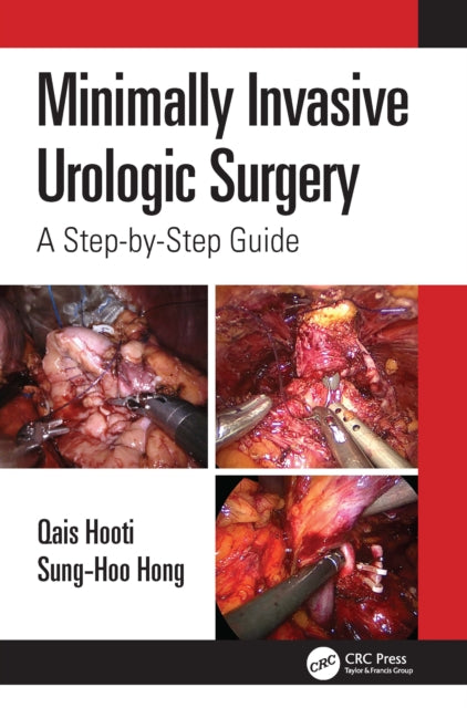 Book cover of: Minimally Invasive Urologic Surgery. By: Qais Hooti
