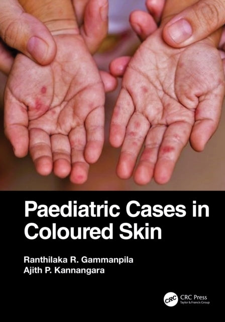Book cover of: Paediatric Cases in Coloured Skin. By: Ranthilaka R. Gammanpila