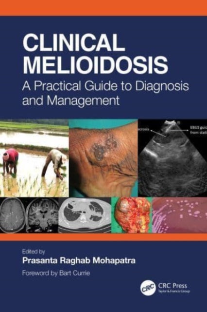 Book cover of: Clinical Melioidosis. By: Prasanta Raghab Mohapatra