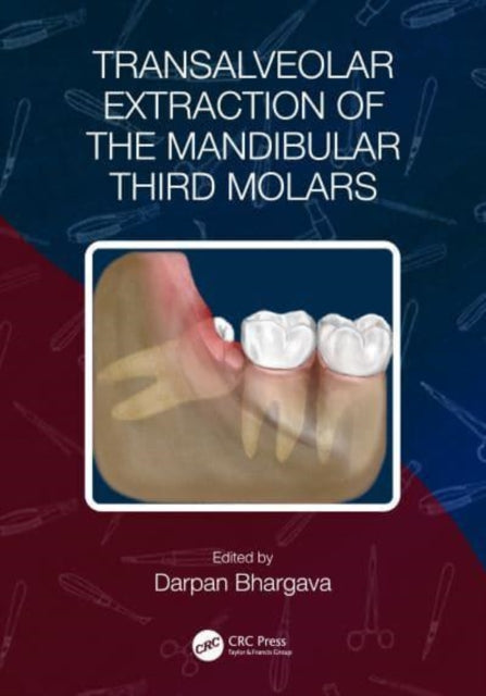 Book cover of: Transalveolar Extraction of the Mandibular Third Molars. By: Darpan Bhargava