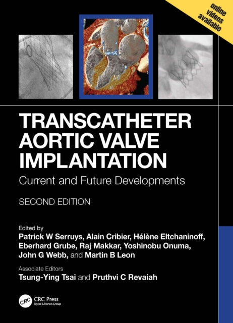 Book cover of: Transcatheter Aortic Valve Implantation