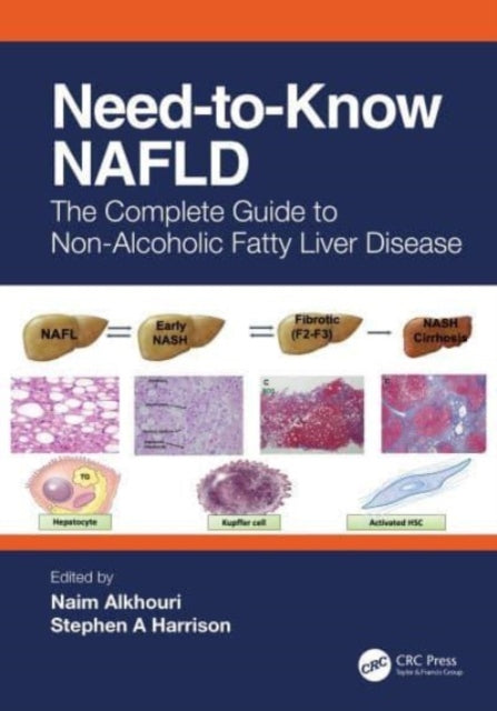 Book cover of: Need-to-Know NAFLD. By: Naim Alkhouri