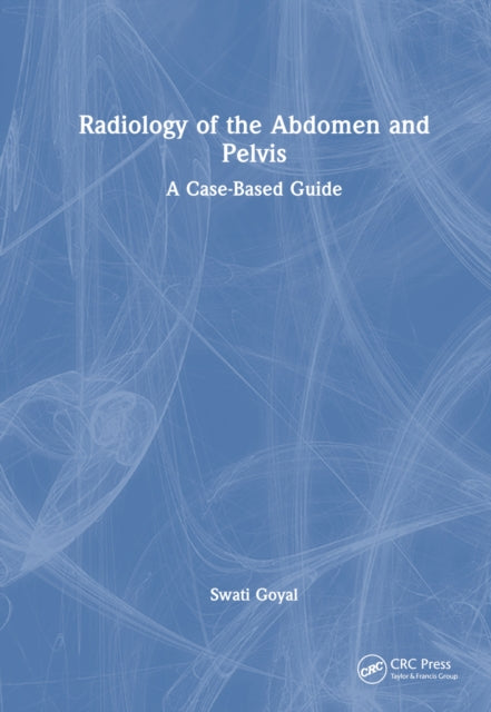 Book cover of: Radiology of the Abdomen and Pelvis. By: Swati Goyal