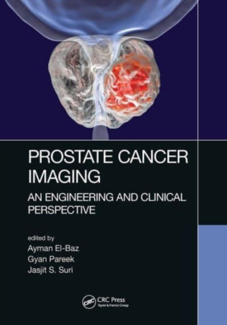 Prostate Cancer Imaging