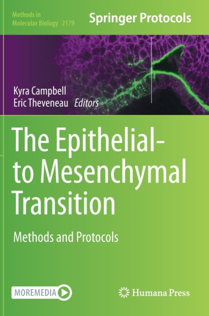 Book cover of: Epithelial-to Mesenchymal Transition. By: Kyra Campbell