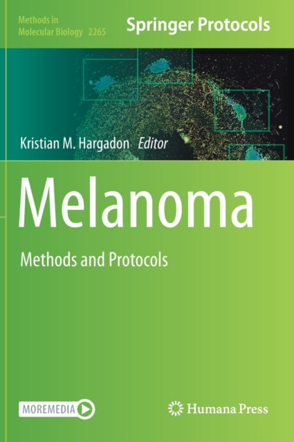 Book cover of: Melanoma. By: Kristian M. Hargadon