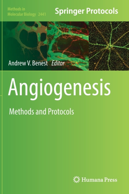 Book cover of: Angiogenesis. By: Andrew V. Benest