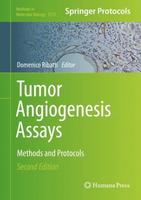 Book cover of: Tumor Angiogenesis Assays. By: Domenico Ribatti