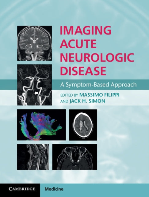 Book cover of: Imaging Acute Neurologic Disease. By: Massimo Filippi
