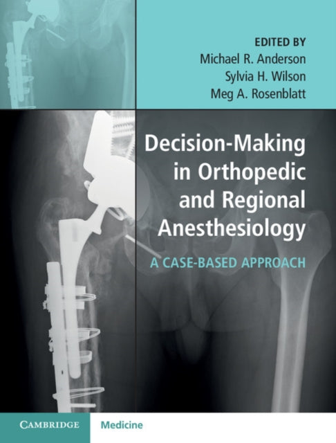 Book cover of: Decision-Making in Orthopedic and Regional Anesthesiology. By: Michael R. Anderson