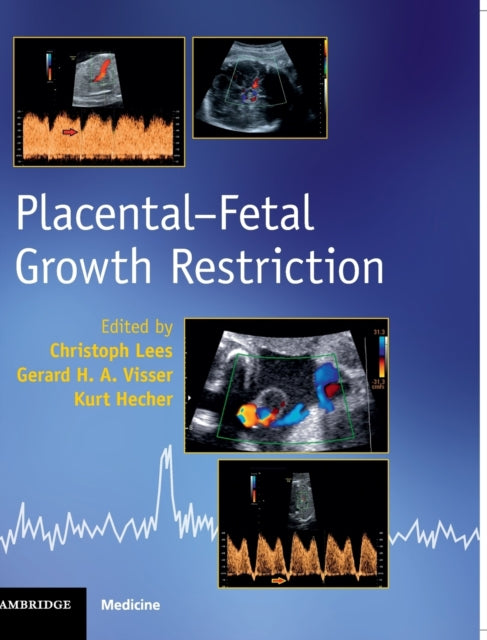 Book cover of: Placental-Fetal Growth Restriction. By: Christoph Lees