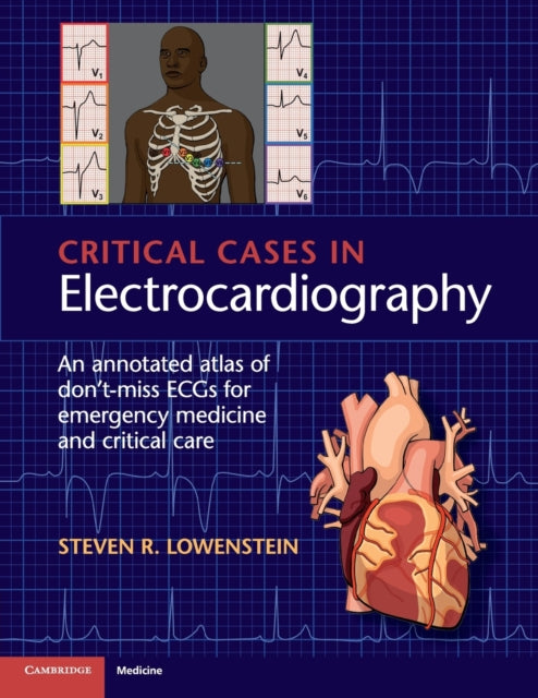 Book cover of: Critical Cases in Electrocardiography. By: Steven R. Lowenstein