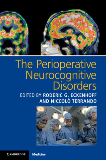 Book cover of: Perioperative Neurocognitive Disorders. By: Roderic G. Eckenhoff