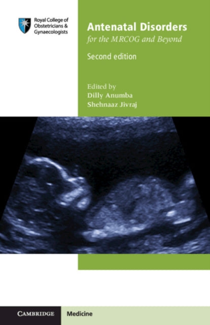 Book cover of: Antenatal Disorders for the MRCOG and Beyond. By: Dilly Anumba