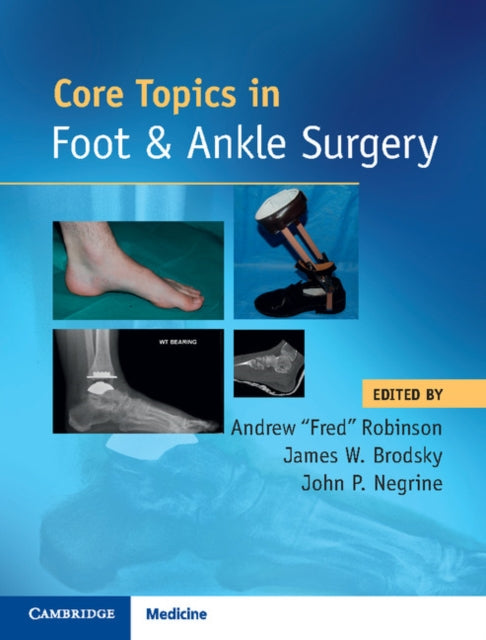 Book cover of: Core Topics in Foot and Ankle Surgery