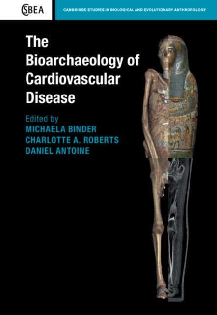 Book cover of: Bioarchaeology of Cardiovascular Disease. By: Michaela Binder