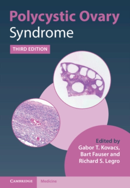 Book cover of: Polycystic Ovary Syndrome. By: Gabor Kovacs