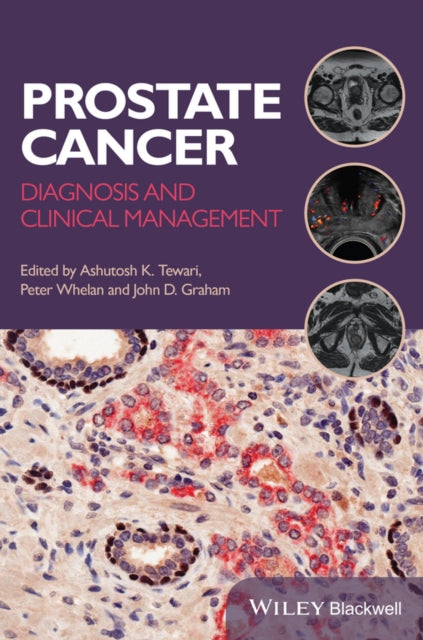 Book cover of: Prostate Cancer