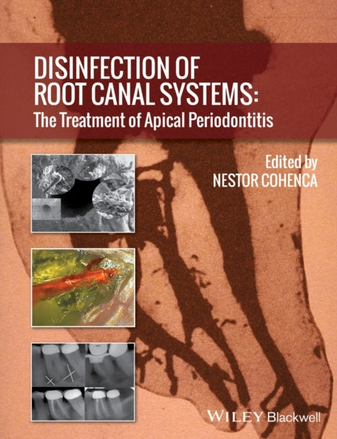 Book cover of: Disinfection of Root Canal Systems