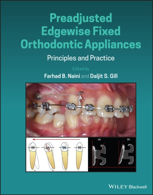 Book cover of: Preadjusted Edgewise Fixed Orthodontic Appliances. By: Farhad B. Naini