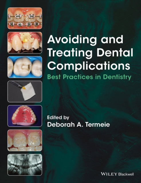 Book cover of: Avoiding and Treating Dental Complications. By: Deborah A. Termeie