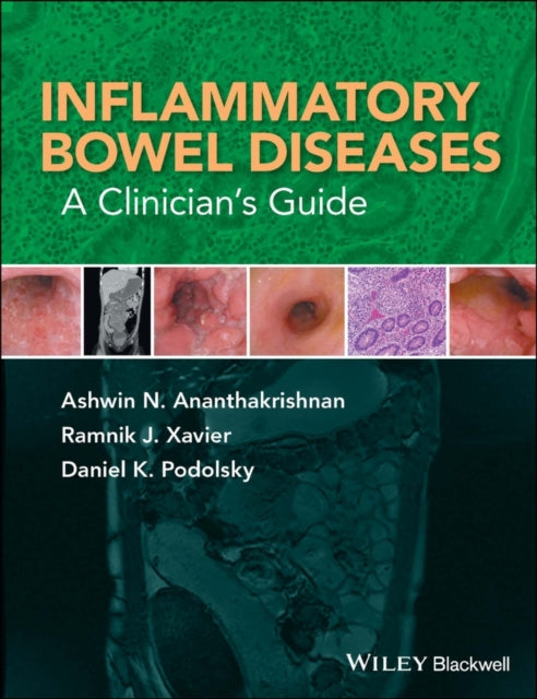 Book cover of: Inflammatory Bowel Diseases. By: Ashwin N. Ananthakrishnan