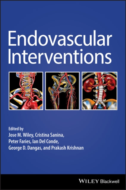 Book cover of: Endovascular Interventions