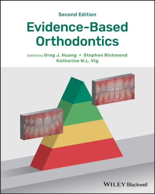 Book cover of: Evidence-Based Orthodontics