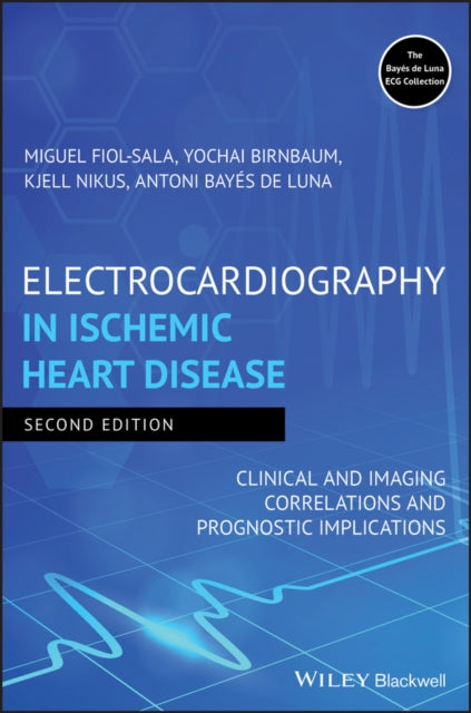 Book cover of: Electrocardiography in Ischemic Heart Disease. By: Miguel Fiol-Sala