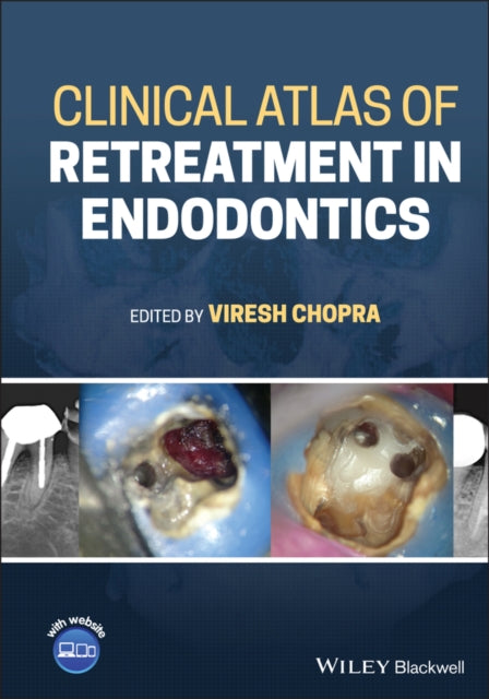 Book cover of: Clinical Atlas of Retreatment in Endodontics. By: Viresh Chopra