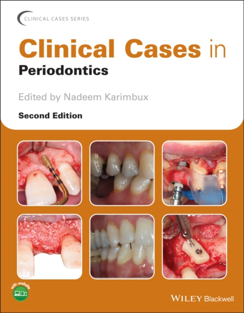 Book cover of: Clinical Cases in Periodontics. By: Nadeem Karimbux